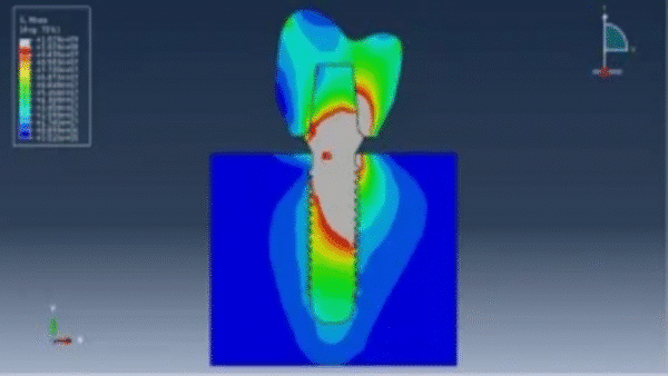 Simulation of Dental Implant Interaction with Mandible Bone Under Dynamic Load in Abaqus