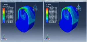 Simulation of Thread Pitch Effects on Stress Distribution in Dental Implants