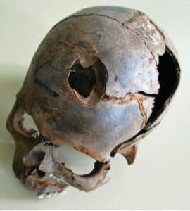 Arrowhead impact on skull