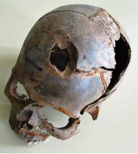 Arrowhead’s impact on the human skull , Weapon and trauma in the Bronze Age