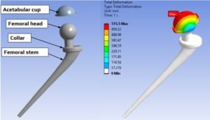 Hip prosthesis FEA model
