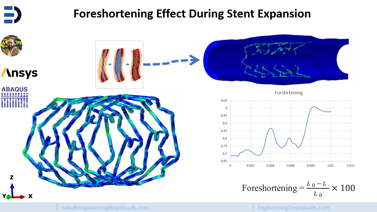 Finite Element Analysis of Stent Deployment in Vessel with Symmetric Plaque