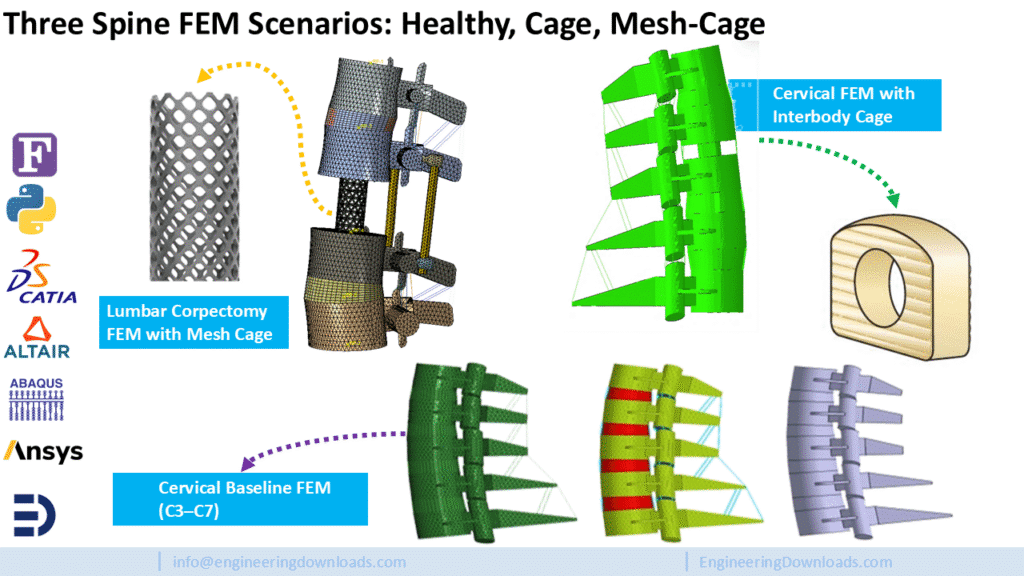 Spine finite element models